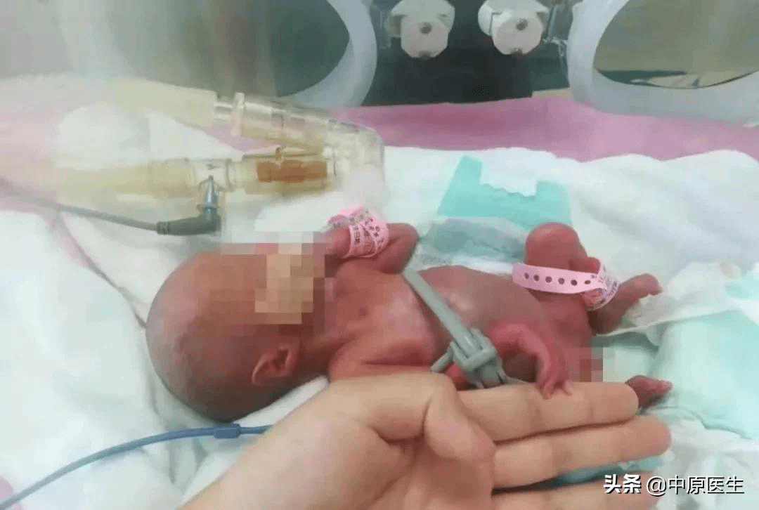 生孩子多难：做试管婴儿，怀双胞胎被迫减胎，
