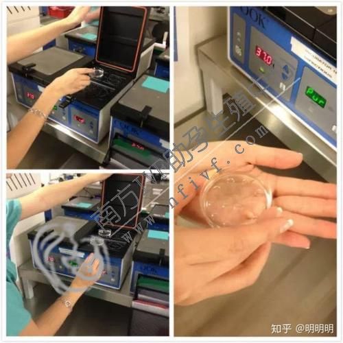 郑州借卵流程:南平哪家医院可以做试管婴儿