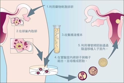 郑州正规试管婴儿套餐:郑州哪家医院可以做三代试管婴儿？