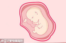 郑州正规试管婴儿套餐_医院为子宫动脉栓塞术做什么准备